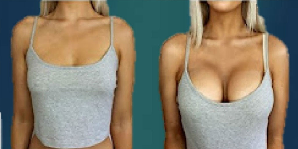 Prevent Sagging Breasts Naturally with THESE Tips! - David Avocado